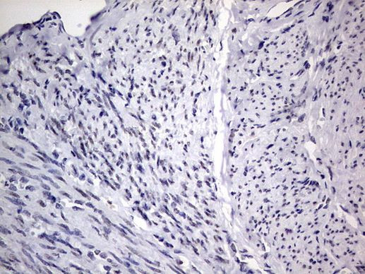 RTRAF Antibody in Immunohistochemistry (Paraffin) (IHC (P))