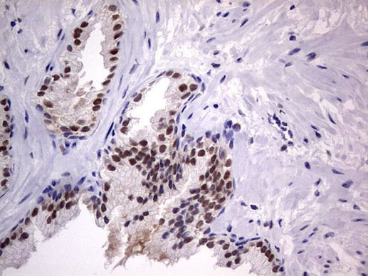 RTRAF Antibody in Immunohistochemistry (Paraffin) (IHC (P))