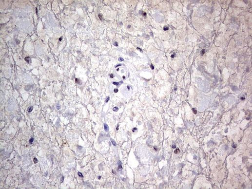 RTRAF Antibody in Immunohistochemistry (Paraffin) (IHC (P))