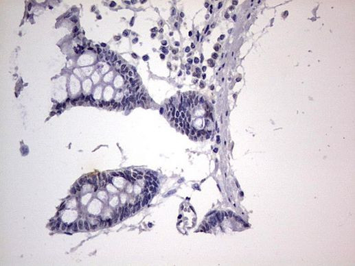 RTRAF Antibody in Immunohistochemistry (Paraffin) (IHC (P))