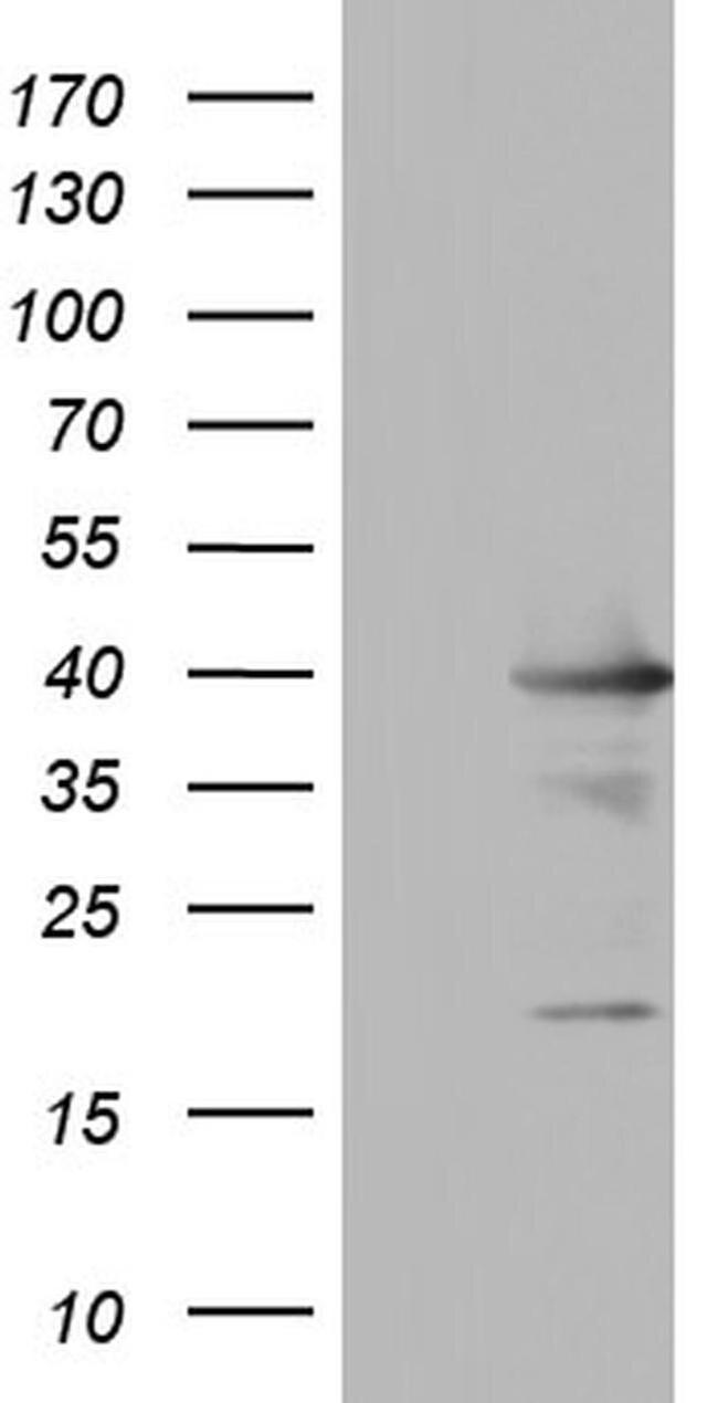 UFD1L Antibody in Western Blot (WB)