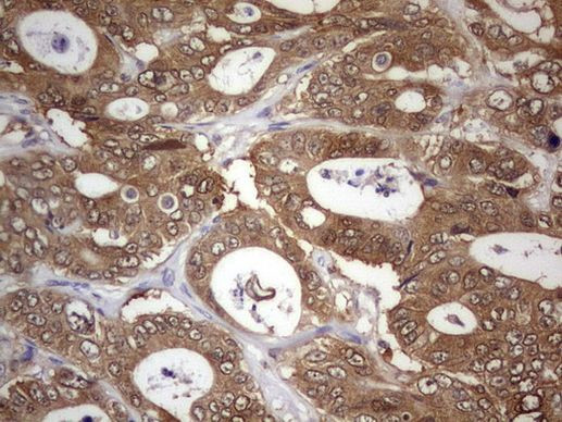 PAFAH1B3 Antibody in Immunohistochemistry (Paraffin) (IHC (P))