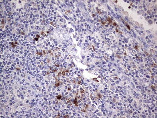 RSPO1 Antibody in Immunohistochemistry (Paraffin) (IHC (P))