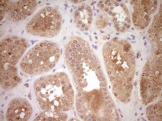 SAV1 Antibody in Immunohistochemistry (Paraffin) (IHC (P))