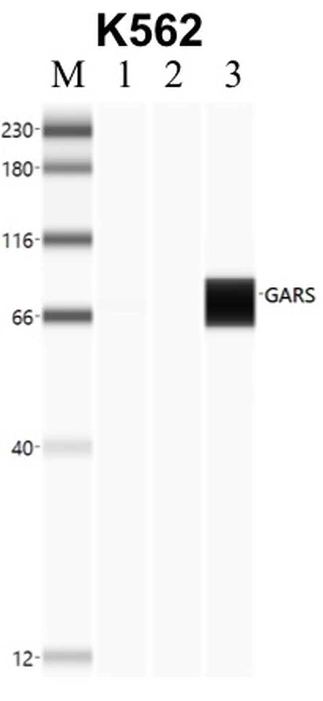 GARS Antibody in RNA Immunoprecipitation (RIP)