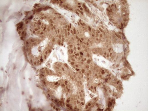 GFI1 Antibody in Immunohistochemistry (Paraffin) (IHC (P))