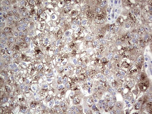 ABH1 Antibody in Immunohistochemistry (Paraffin) (IHC (P))