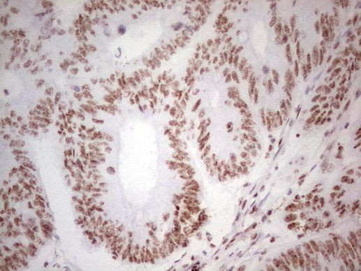 ABH1 Antibody in Immunohistochemistry (Paraffin) (IHC (P))