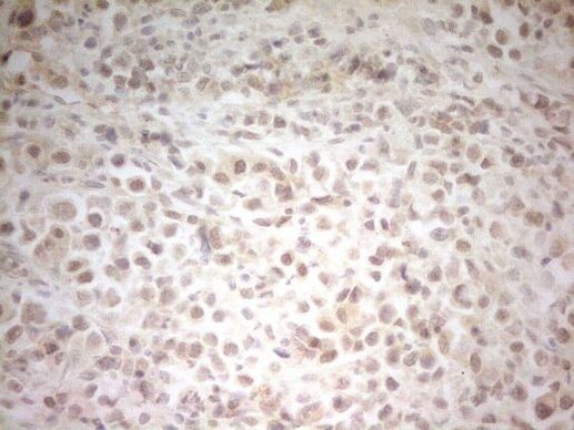 HSF2 Antibody in Immunohistochemistry (Paraffin) (IHC (P))