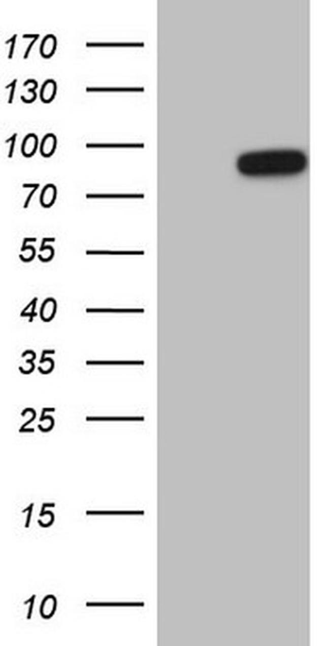 HSF2 Antibody in Western Blot (WB)