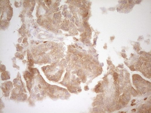 Bmf Antibody in Immunohistochemistry (Paraffin) (IHC (P))