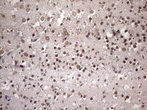 NUP43 Antibody in Immunohistochemistry (Paraffin) (IHC (P))