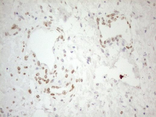 Pellino 1 Antibody in Immunohistochemistry (Paraffin) (IHC (P))