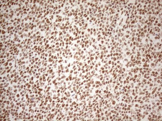 WTAP Antibody in Immunohistochemistry (Paraffin) (IHC (P))