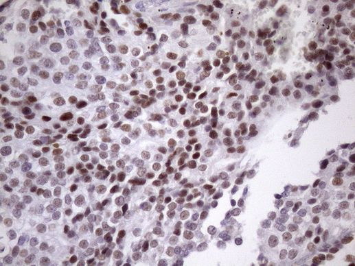 SRSF9 Antibody in Immunohistochemistry (Paraffin) (IHC (P))