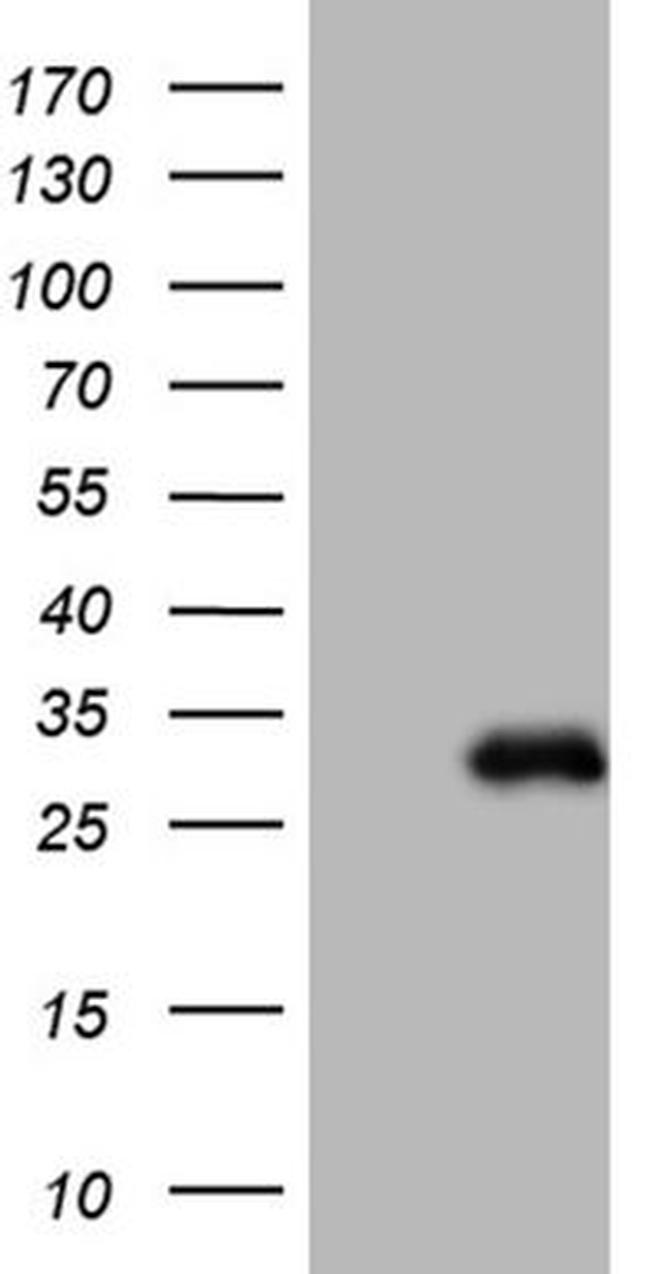 betatrophin Antibody in Western Blot (WB)