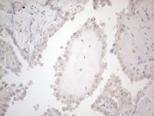 betatrophin Antibody in Immunohistochemistry (Paraffin) (IHC (P))