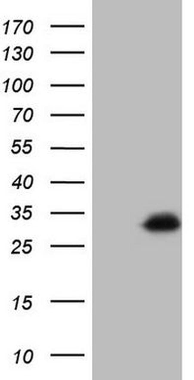 betatrophin Antibody in Western Blot (WB)