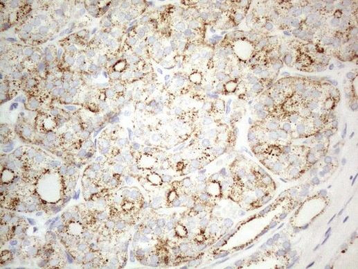 ZNF217 Antibody in Immunohistochemistry (Paraffin) (IHC (P))