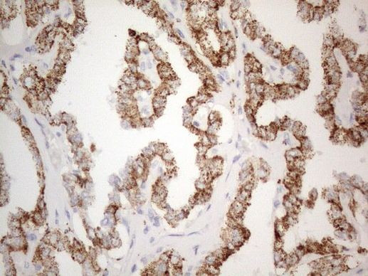 ZNF217 Antibody in Immunohistochemistry (Paraffin) (IHC (P))