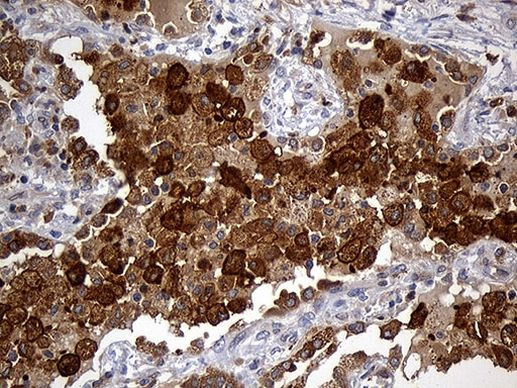 GRB7 Antibody in Immunohistochemistry (Paraffin) (IHC (P))