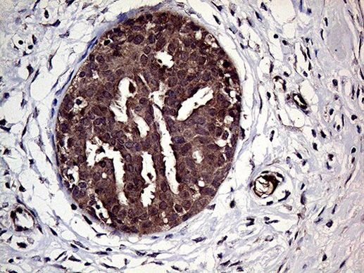 HABP2 Antibody in Immunohistochemistry (Paraffin) (IHC (P))