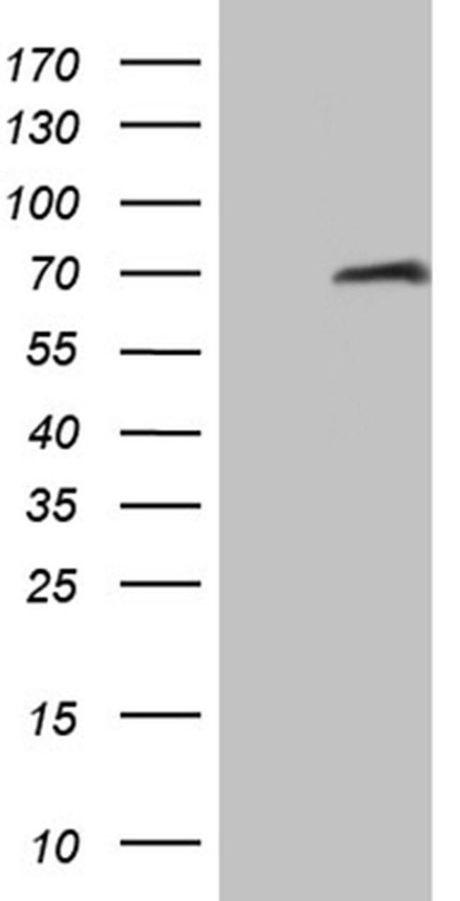 HABP2 Antibody in Western Blot (WB)