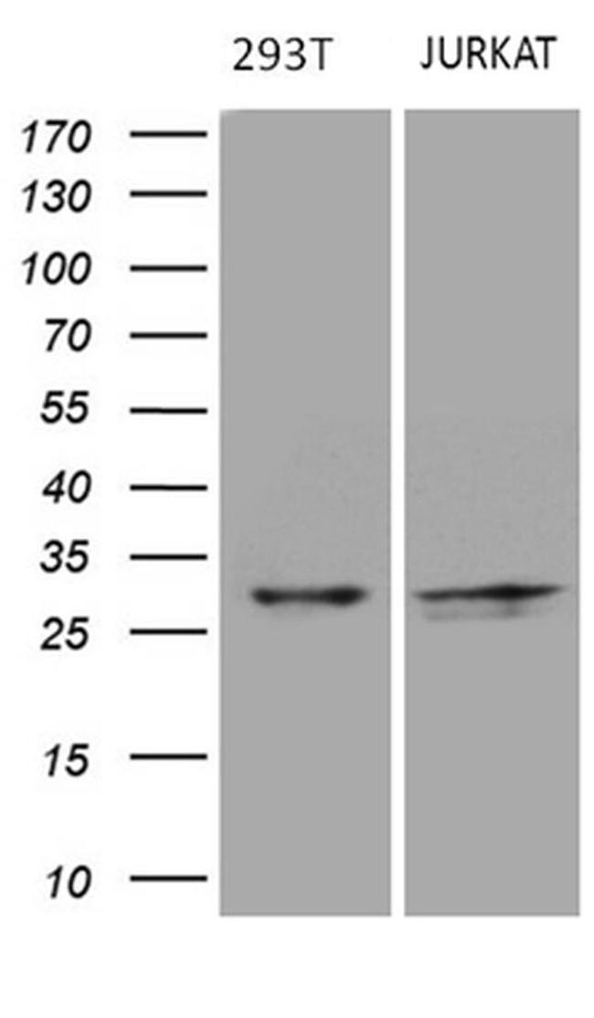 DIRAS2 Antibody in Western Blot (WB)