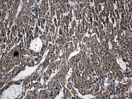 DHRS4L2 Antibody in Immunohistochemistry (Paraffin) (IHC (P))