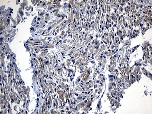 DHRS4L2 Antibody in Immunohistochemistry (Paraffin) (IHC (P))