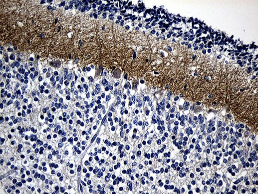 mGluR4 Antibody in Immunohistochemistry (Paraffin) (IHC (P))