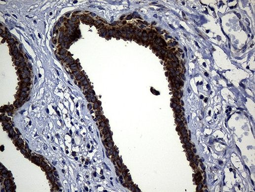 TIMM23 Antibody in Immunohistochemistry (Paraffin) (IHC (P))