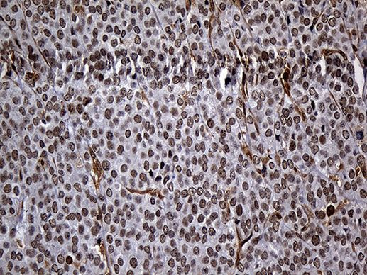 RAD21 Antibody in Immunohistochemistry (Paraffin) (IHC (P))