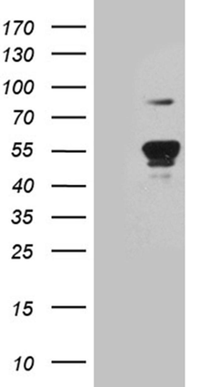 YBX2 Antibody in Western Blot (WB)