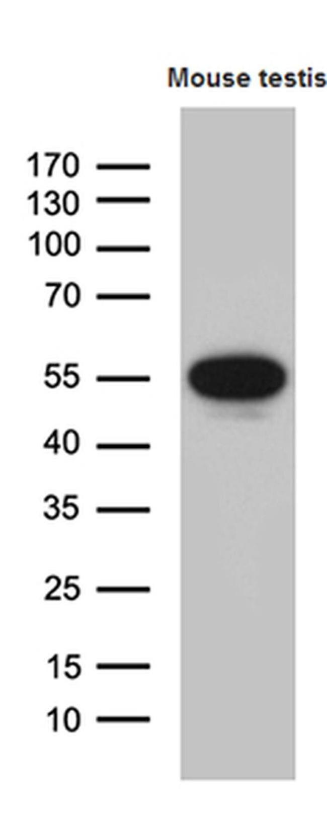 YBX2 Antibody in Western Blot (WB)