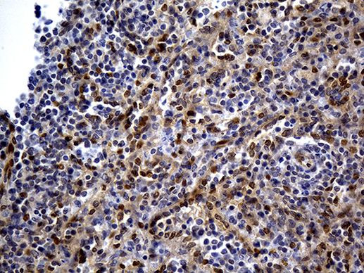 N-WASP Antibody in Immunohistochemistry (Paraffin) (IHC (P))