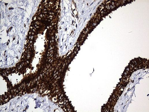 UQCRFS1 Antibody in Immunohistochemistry (Paraffin) (IHC (P))