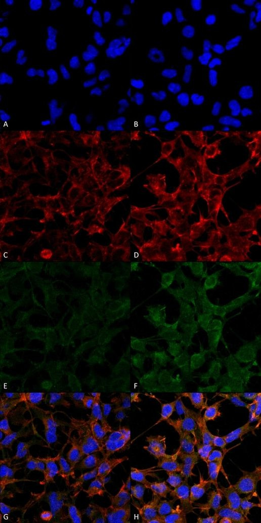 4-Hydroxynonenal Antibody in Immunocytochemistry (ICC/IF)