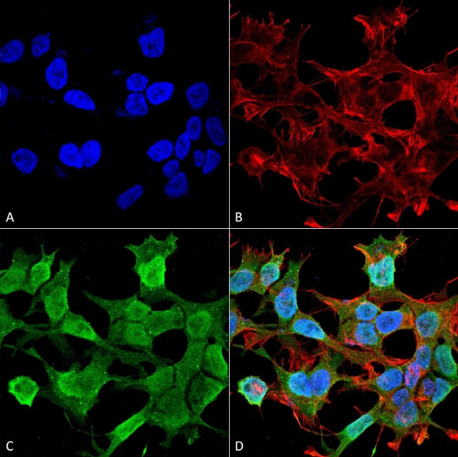 Neuroligin 1 Antibody in Immunocytochemistry (ICC/IF)