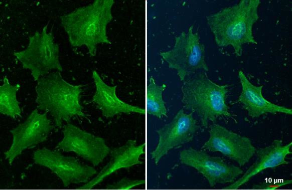 Cofilin Antibody in Immunocytochemistry (ICC/IF)