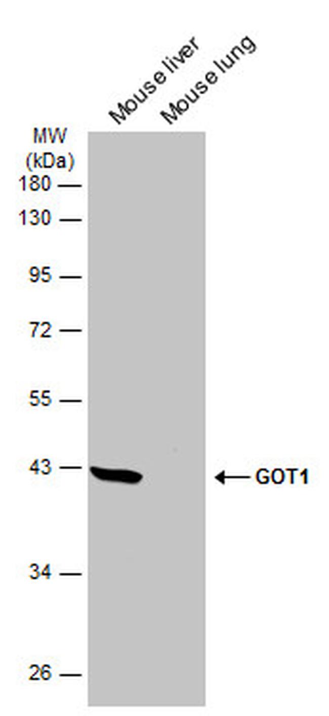 GOT1 Antibody in Western Blot (WB)