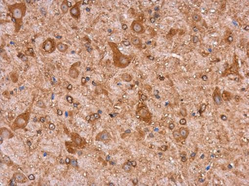 MYH9 Antibody in Immunohistochemistry (Paraffin) (IHC (P))