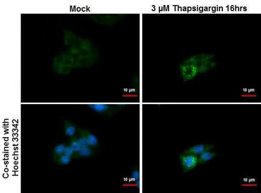 SQSTM1 Antibody in Immunocytochemistry (ICC/IF)