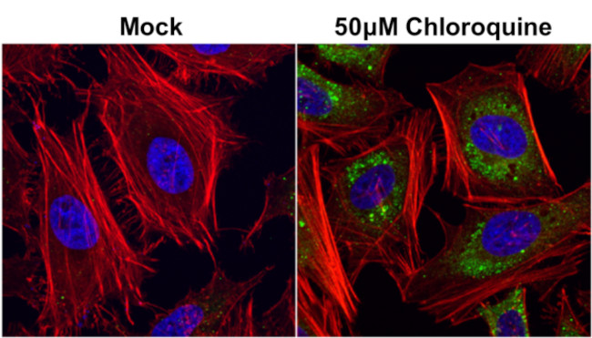 SQSTM1 Antibody in Immunocytochemistry (ICC/IF)