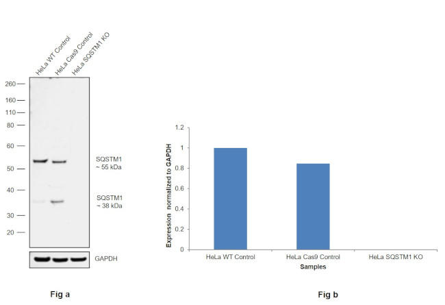 SQSTM1 Antibody