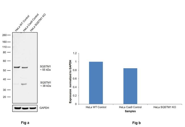 SQSTM1 Antibody in Western Blot (WB)