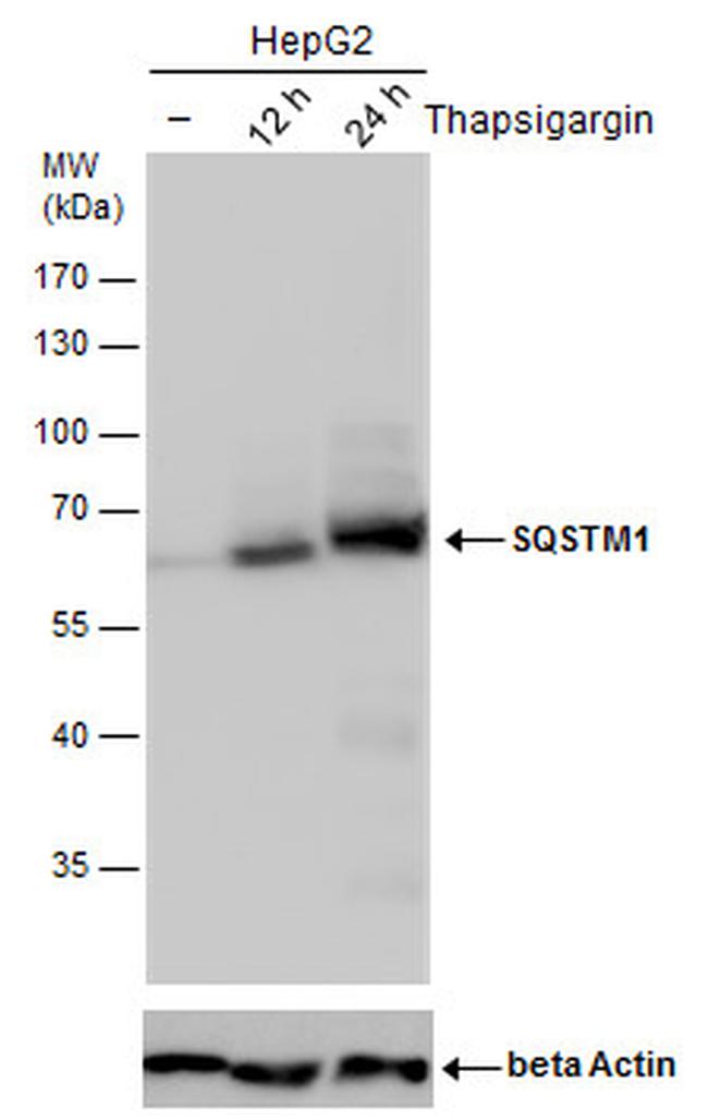 SQSTM1 Antibody in Western Blot (WB)