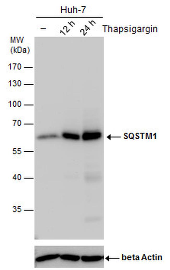 SQSTM1 Antibody in Western Blot (WB)