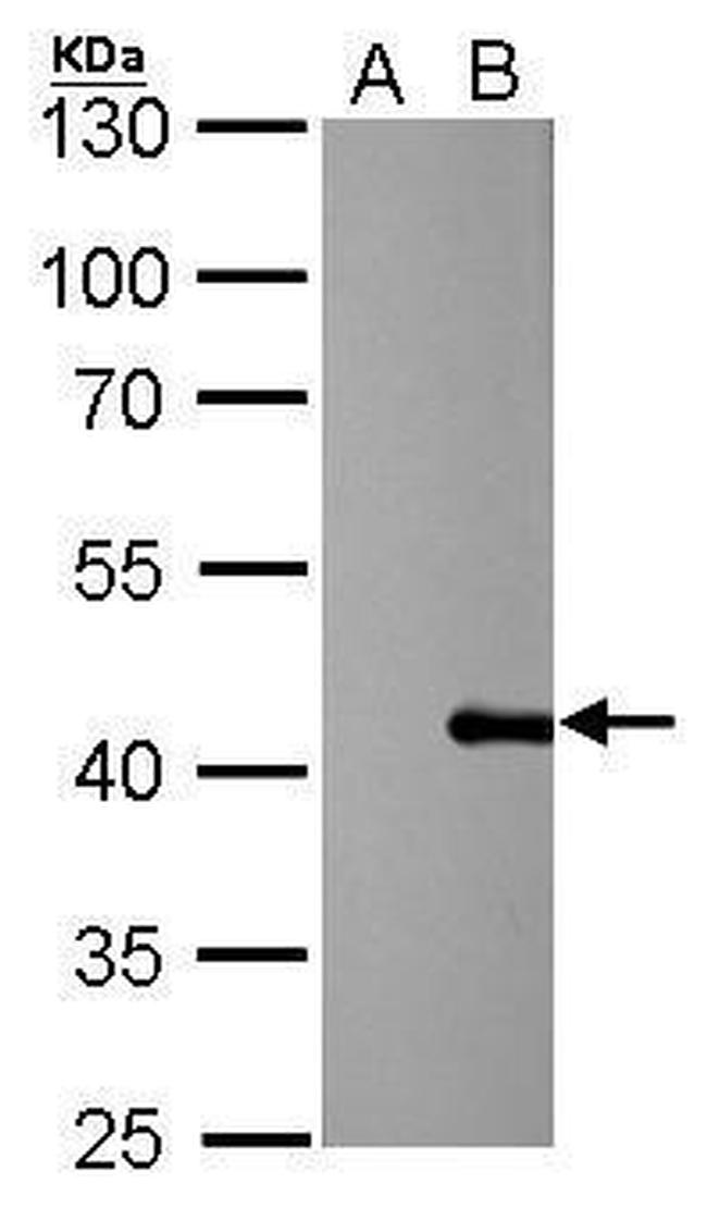 PSRC1 Antibody in Western Blot (WB)