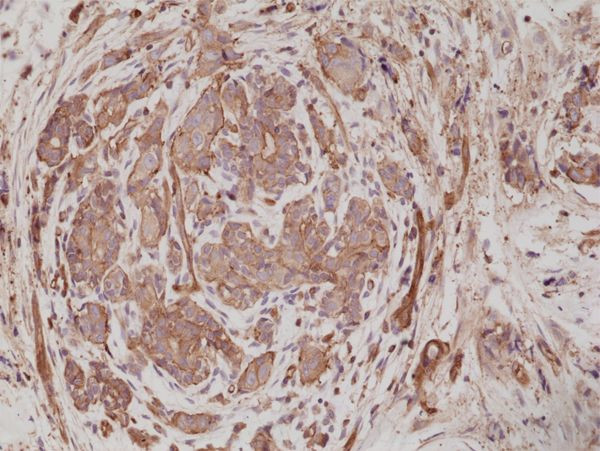 Alpha Actinin 4 Antibody in Immunohistochemistry (Paraffin) (IHC (P))